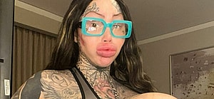 Model’s 38J Breast Implant Explodes, Becomes The ‘Uniboob Queen’