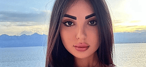 Post Surgery Kim Kardashian Look Alike Sick Of The Comparisons, Working On Reversing Procedures