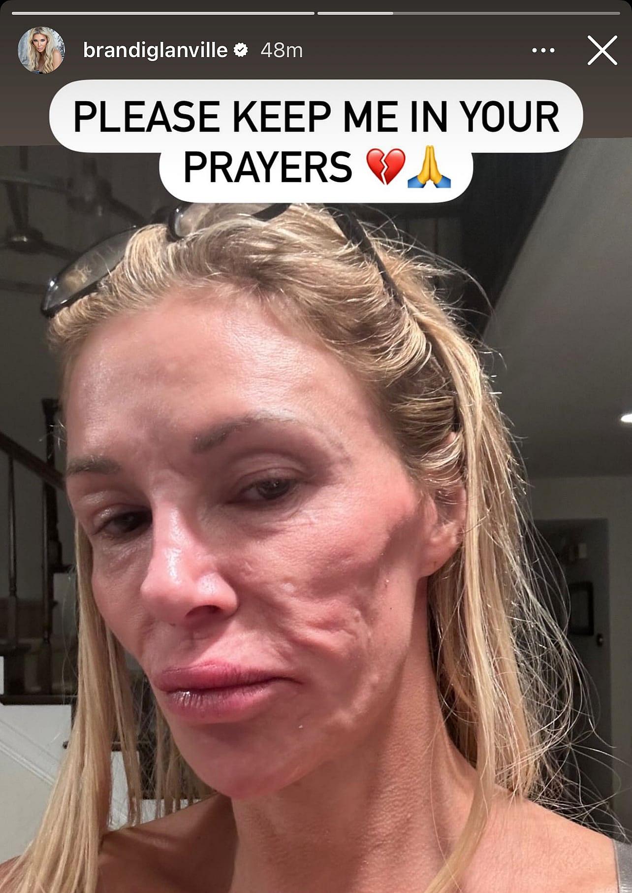Brandi Glanville: Illness Has 'Wiped Out' Her Social Life