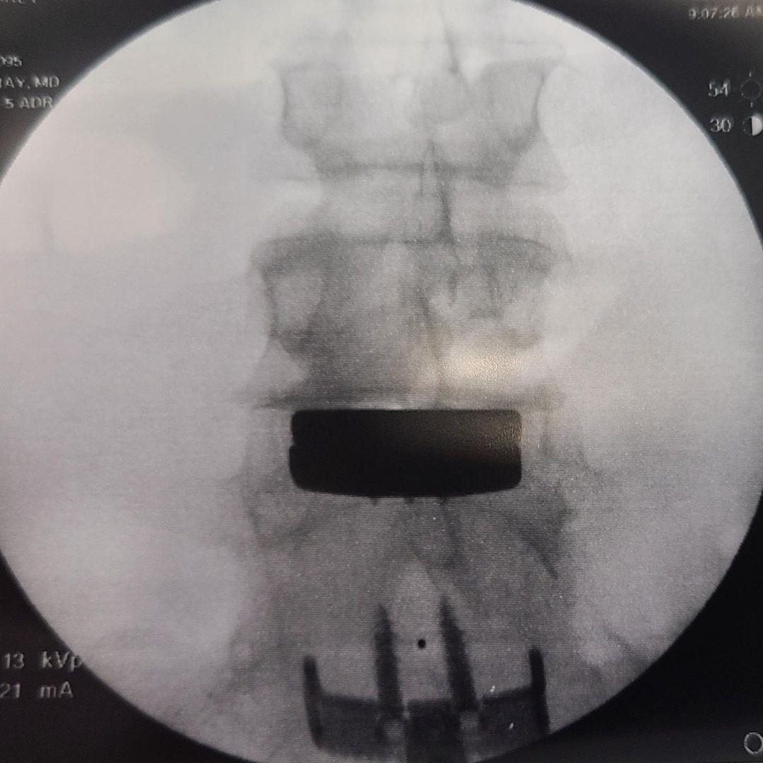 Pink’s Husband, Carey Hart, Shares Footage From Inside Painful Back Surgery!