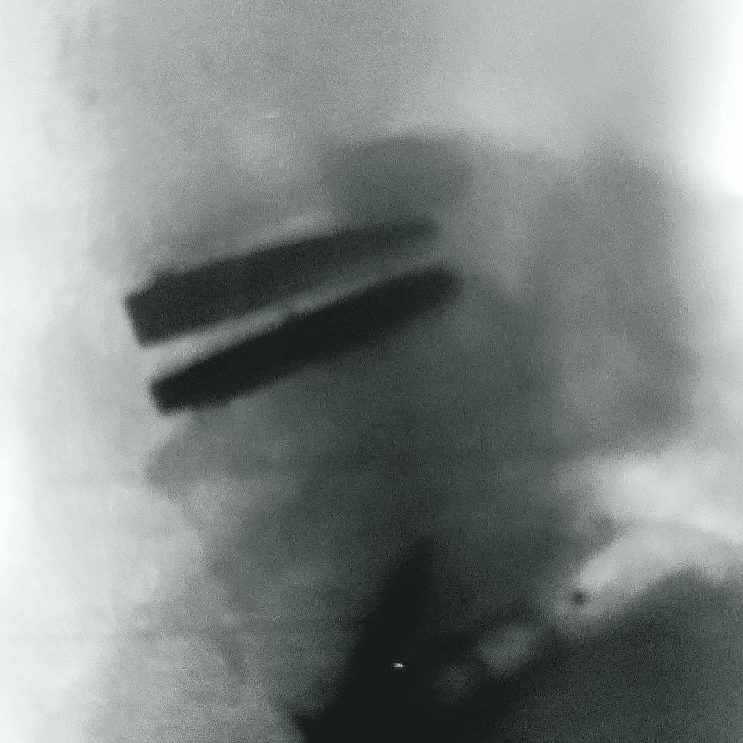 Pink’s Husband, Carey Hart, Shares Footage From Inside Painful Back Surgery!