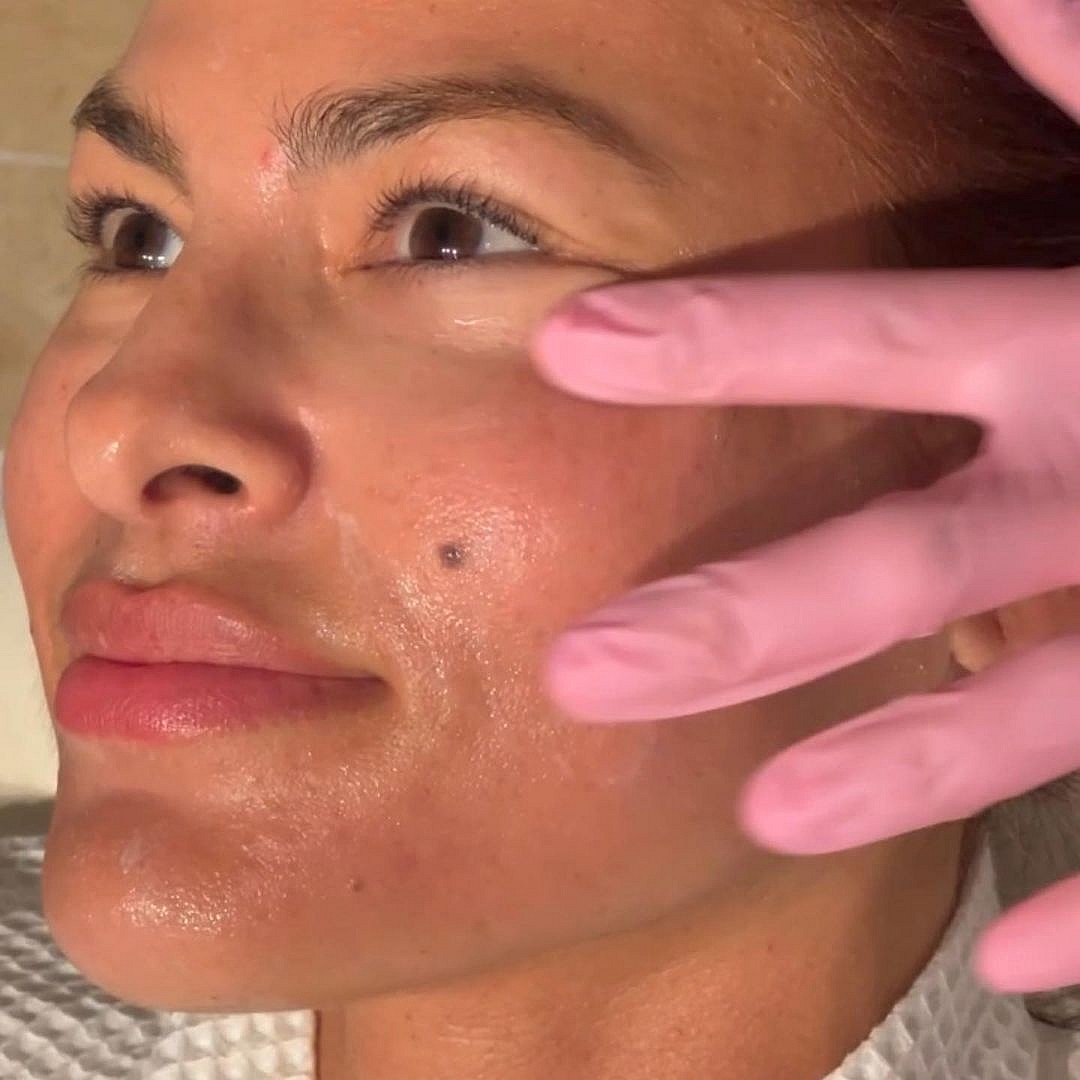 Fans Flood Eva Mendes With Questions On Her Experience With 'Dermaplaning'