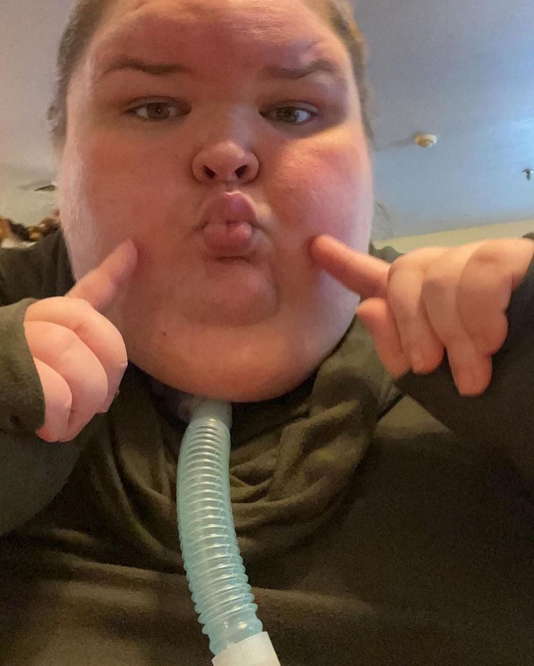 '1000-LB Sisters' Star Shares Shocking Photos With Tracheostomy Tube