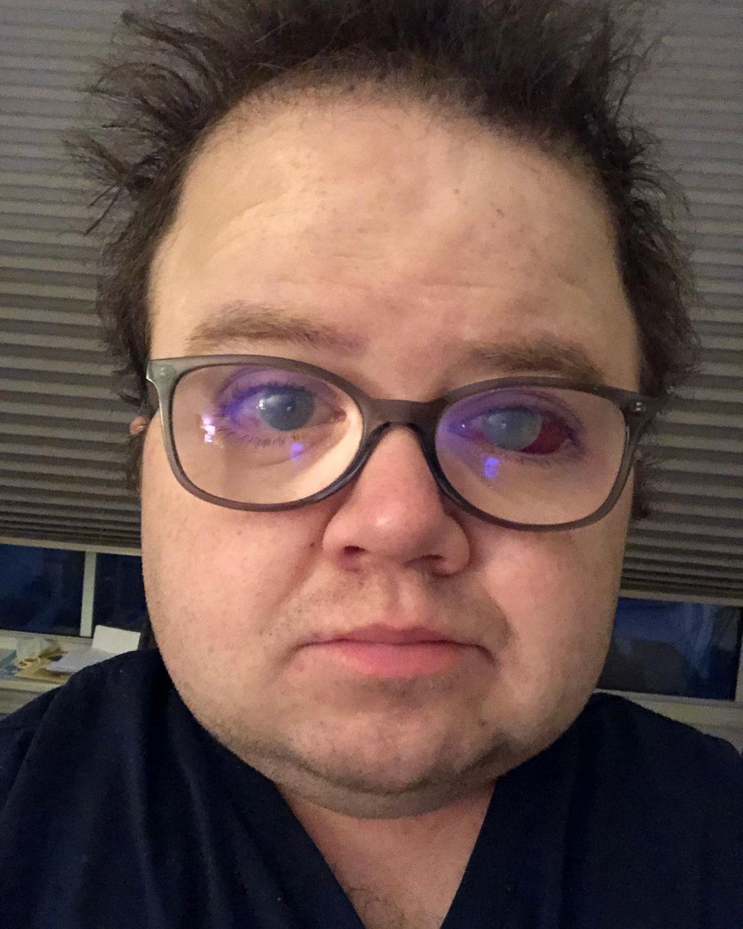 YouTuber Keenan Cahill Passes Away Weeks After Open Heart Surgery