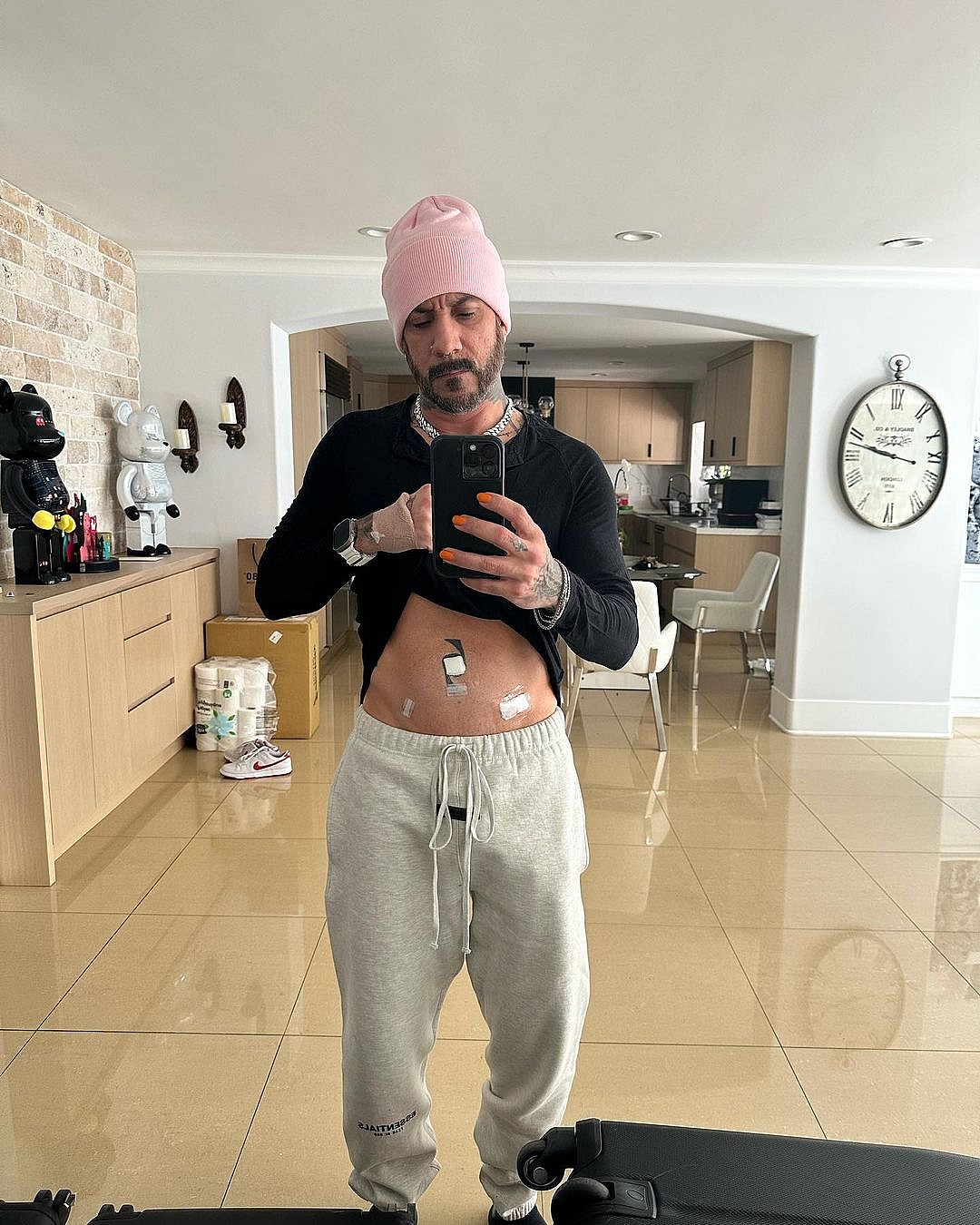 AJ McLean Shares Update On Hernia Surgery And Post Op Amid Marriage Split