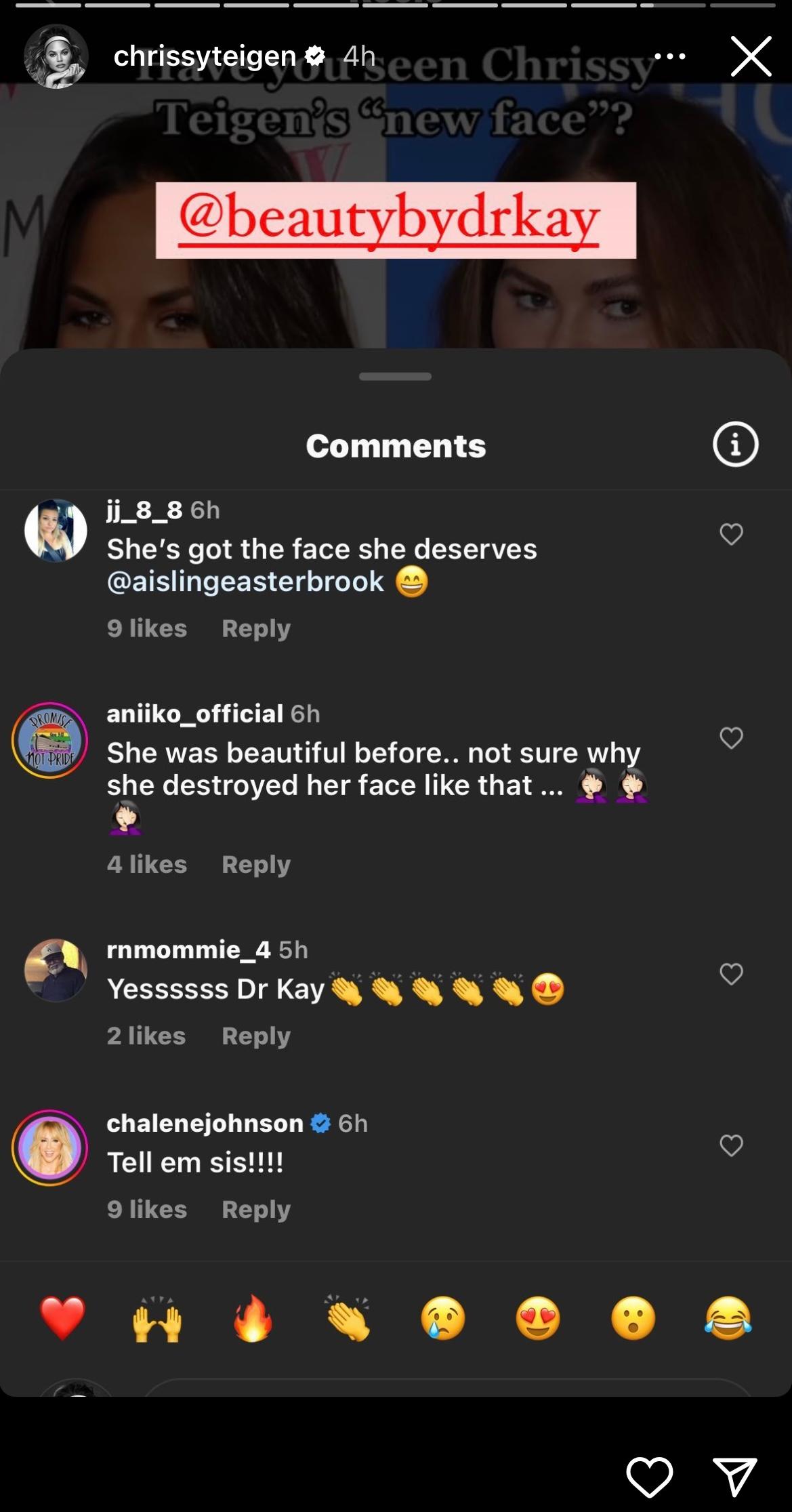 Chrissy Teigen Claps back at plastic surgeon who accused her of using cheek injectors
