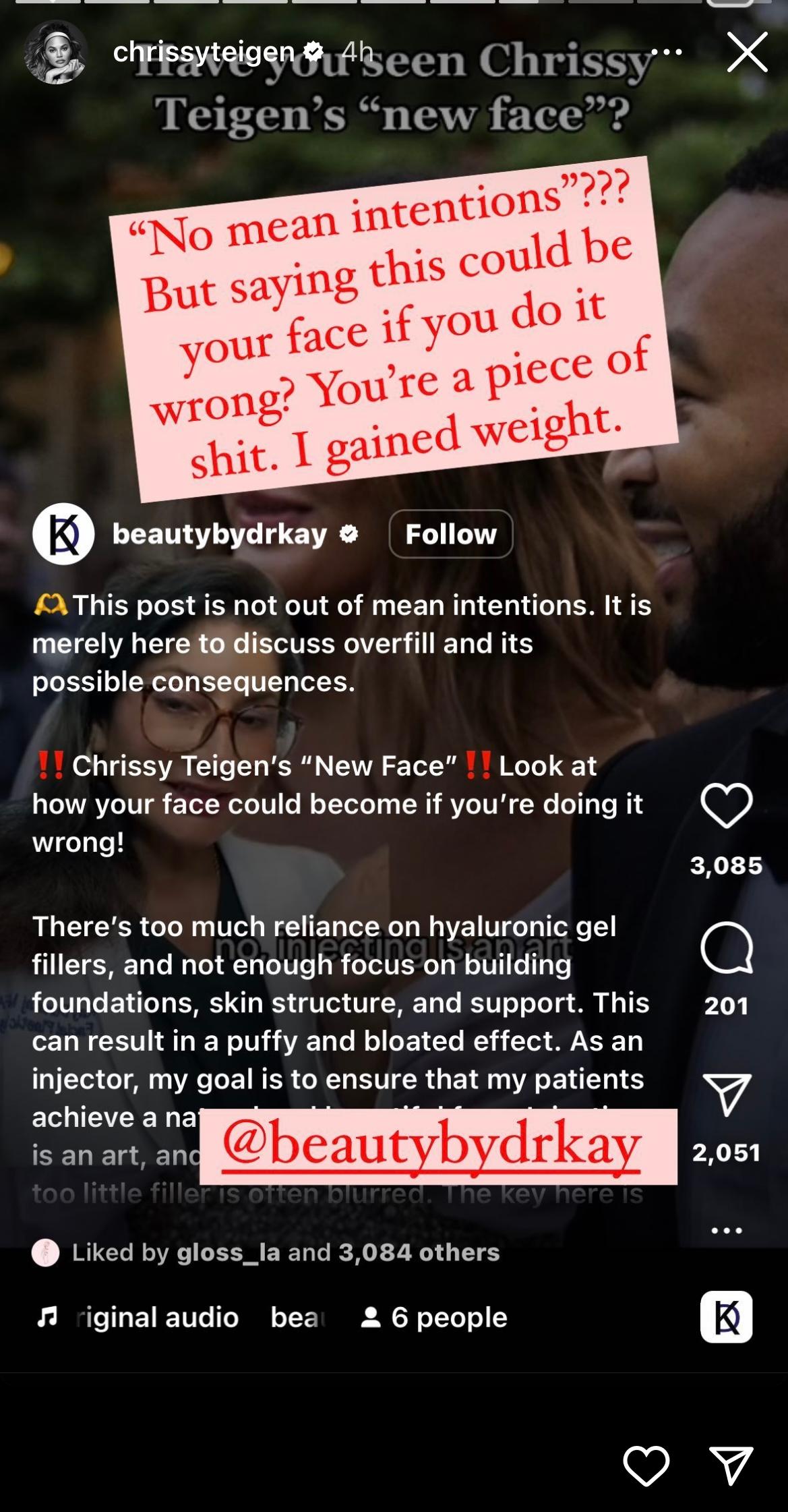 Chrissy Teigen Claps back at plastic surgeon who accused her of using cheek injectors