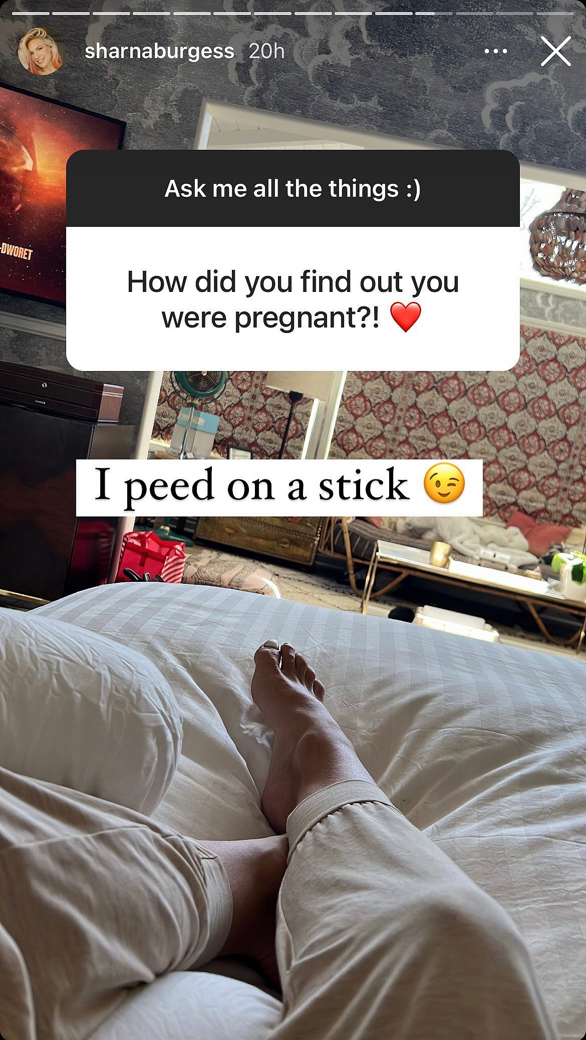 Sharna Burgess' post on her Instagram story