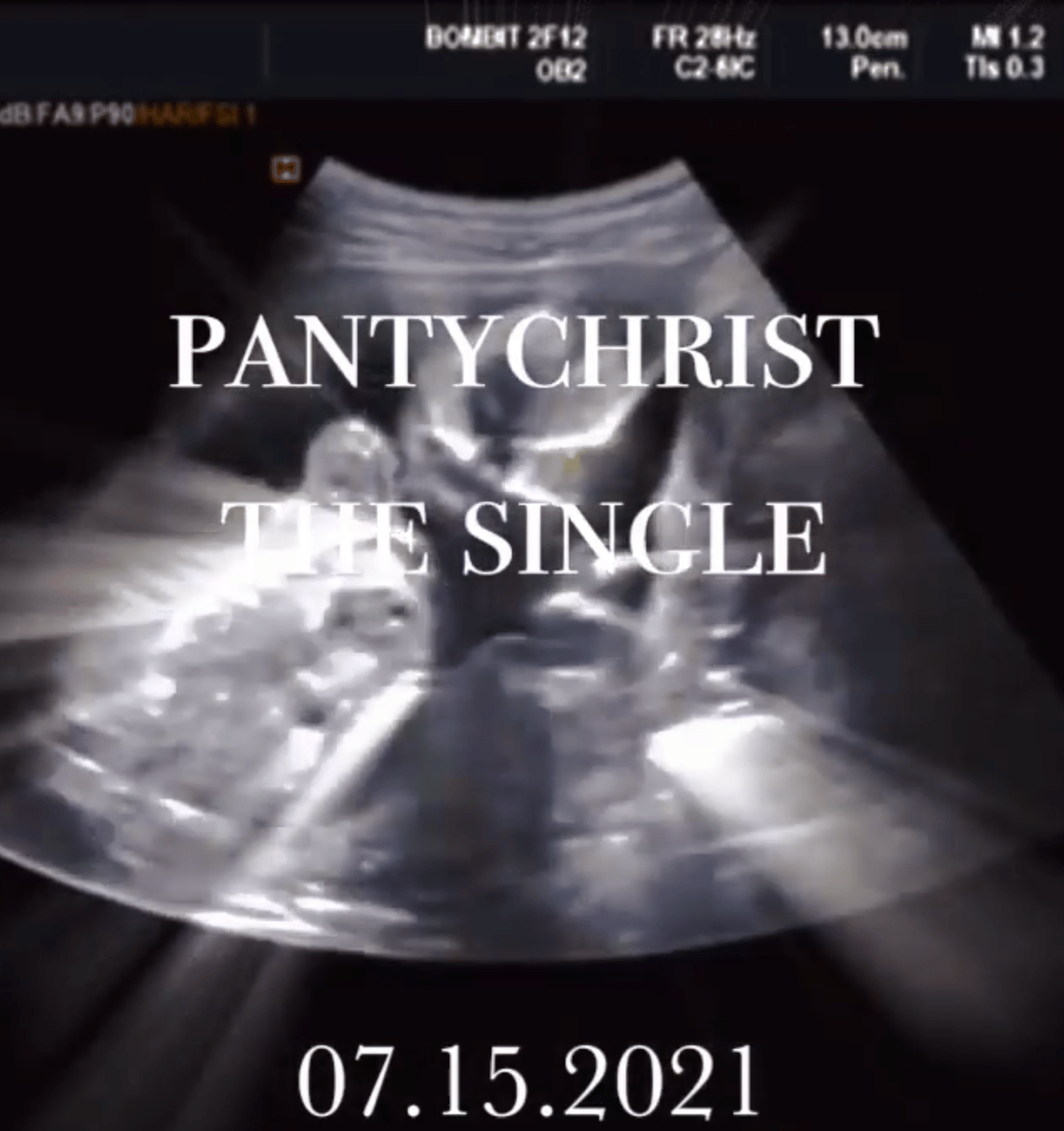 Rapper Lil' Nas X Accused Of Ripping Off 'Gives Birth' Video
