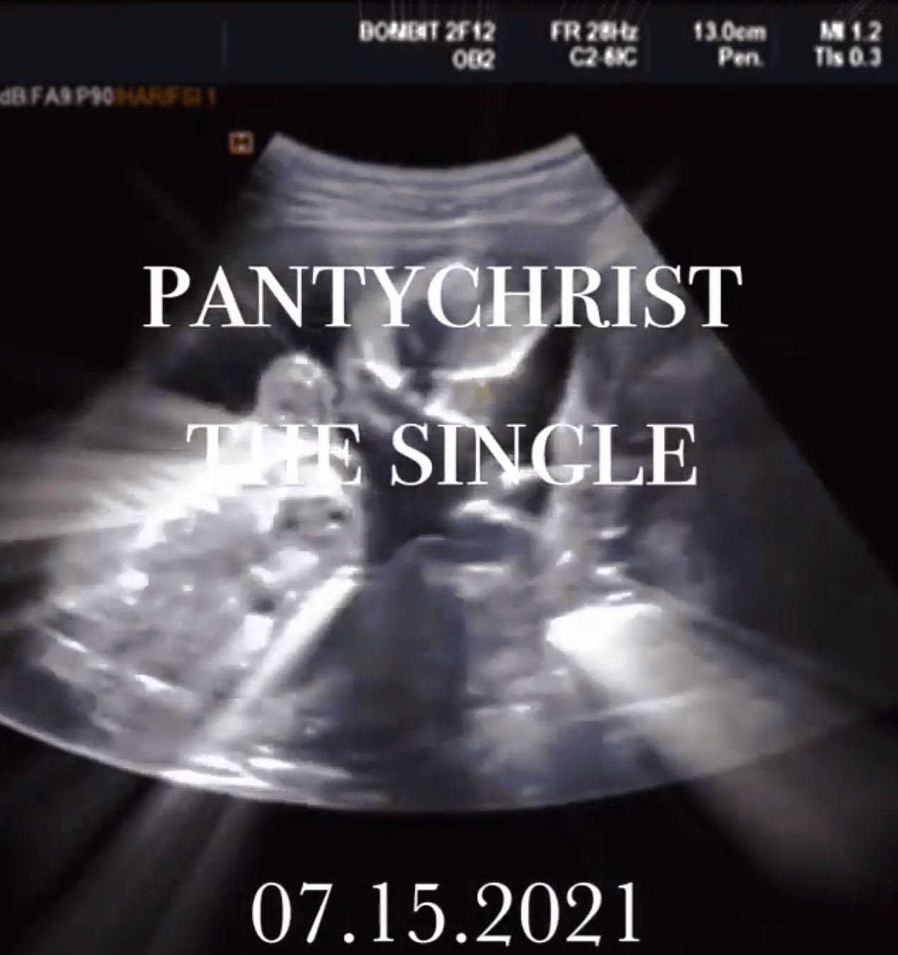 Rapper Lil' Nas X Accused Of Ripping Off 'Gives Birth' Video