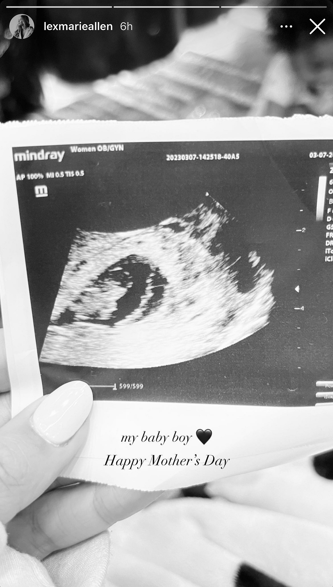 Jimmie Allen's Wife Alexis Gale Unveils Their Third Baby's Gender Amid Divorce