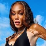 Winnie Harlow gave fans a cheeky update on breasts