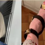 Erika Jayne Reveals Gruesome Bloody Toe In Versace Heels After Nasty Spill At Soho House