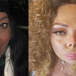 Tonya before the attack (left) Tonya after the attack (right)