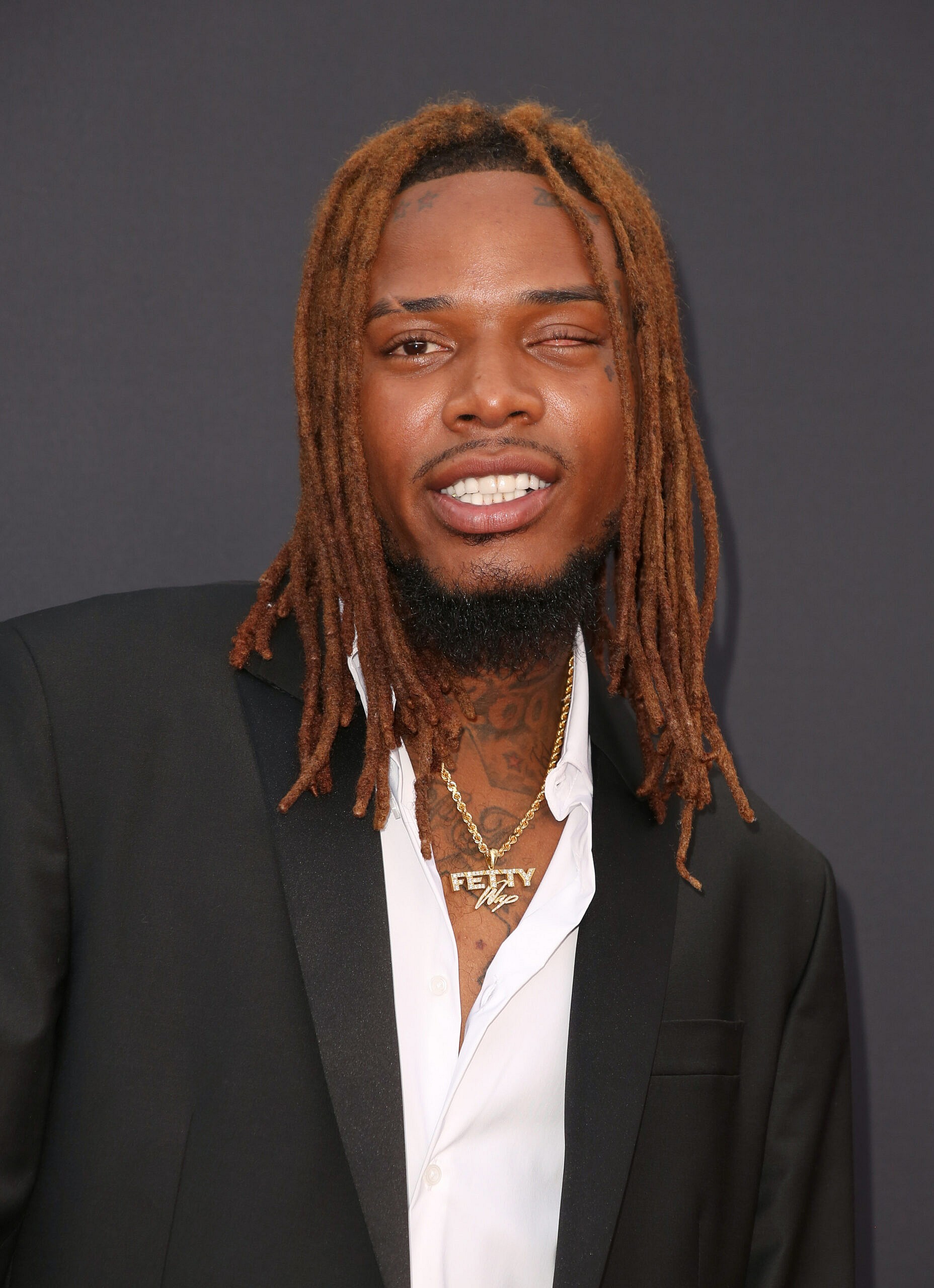 Rapper Fetty Wap Reveals The True Story Behind Losing His Eye 