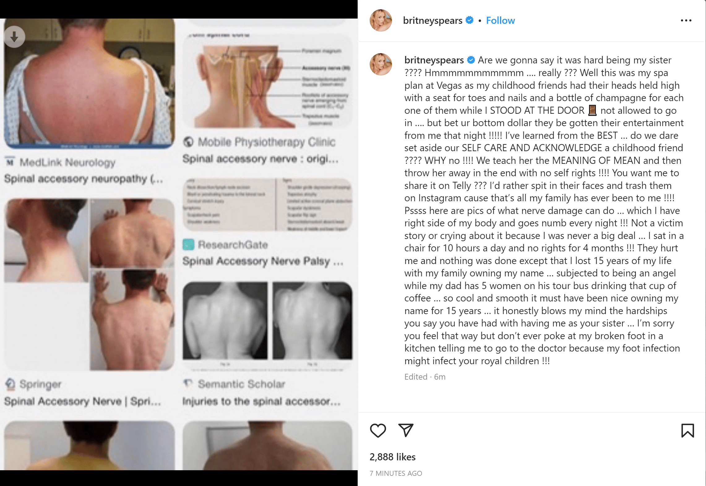 Britney Spears goes off on Jamie Lynn Spears on January 6