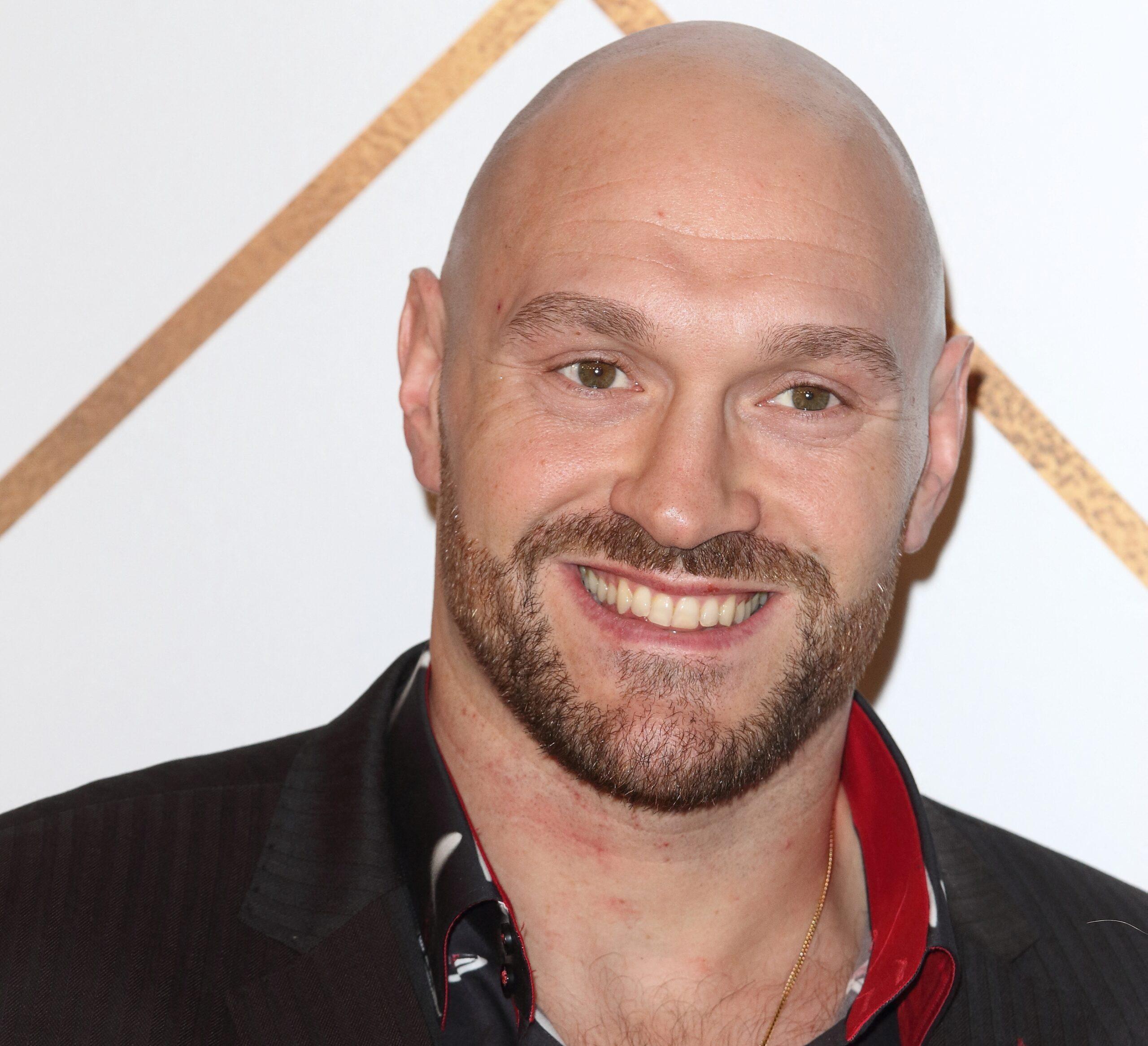 Tyson Fury Suffers Gruesome Cut, Leaves Wife 'Shaken' [PHOTO]