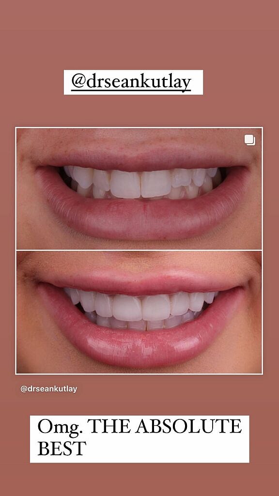 Emily Elizabeth showing her teeth.