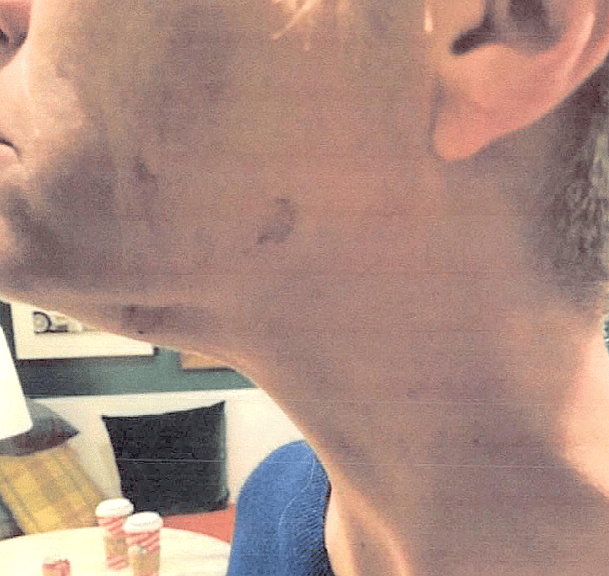  Ronald Carlson seek restraining orders against each other