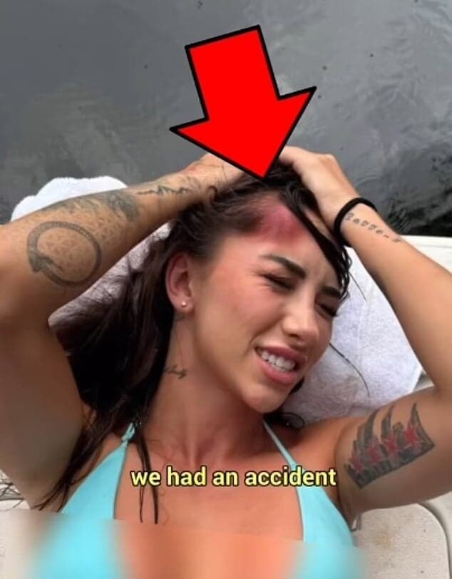 Women injured in TooTurntTony stunt