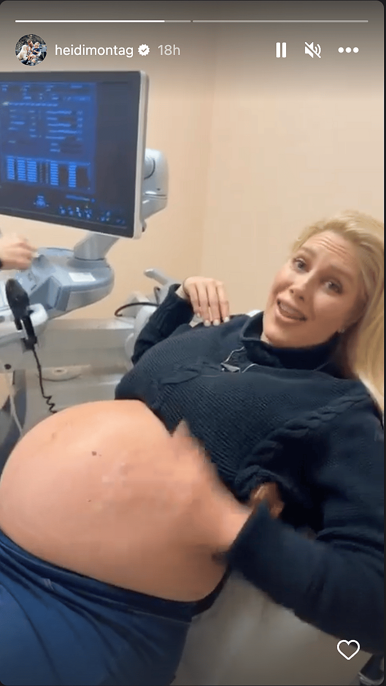 Heidi Montag Is Expecting Her Second Child Early, Documents Progress On IG