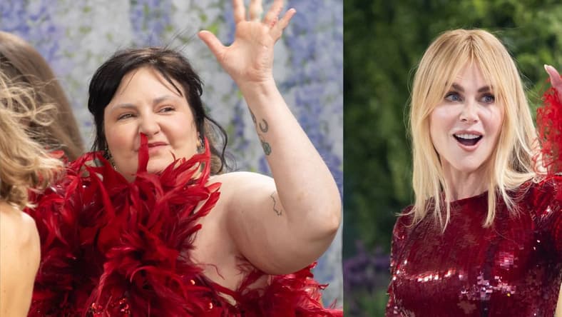 Lena Dunham (left) Nicole Kidman (right)