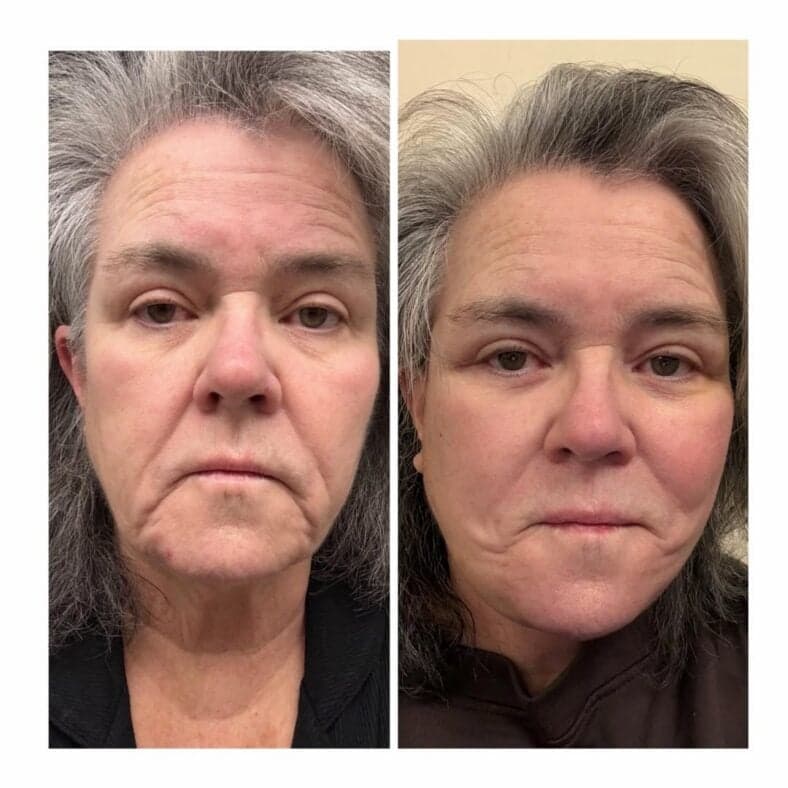 Rosie O'Donnell flaunts facelift results