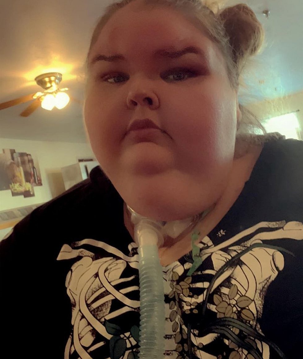 '1000-LB Sisters' Star Shares Shocking Photos With Tracheostomy Tube
