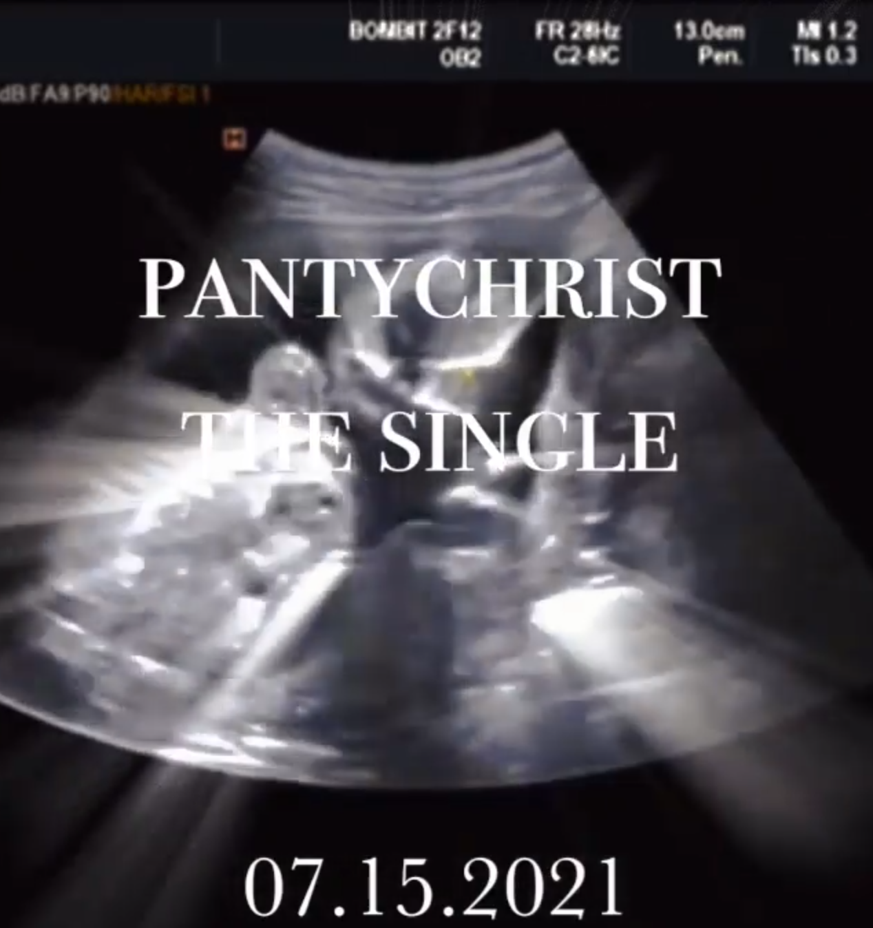 Rapper Lil' Nas X Accused Of Ripping Off 'Gives Birth' Video