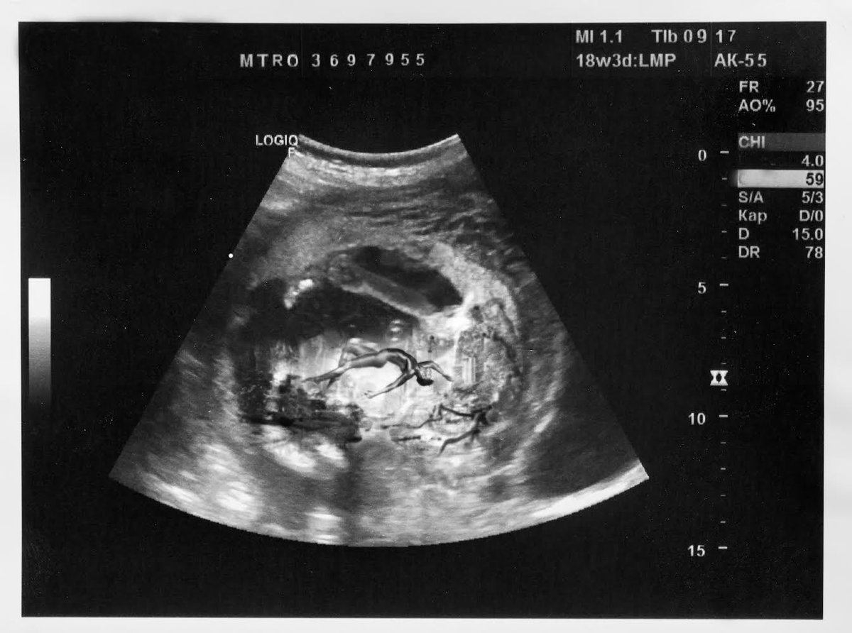 Rapper Lil' Nas X Accused Of Ripping Off 'Gives Birth' Video