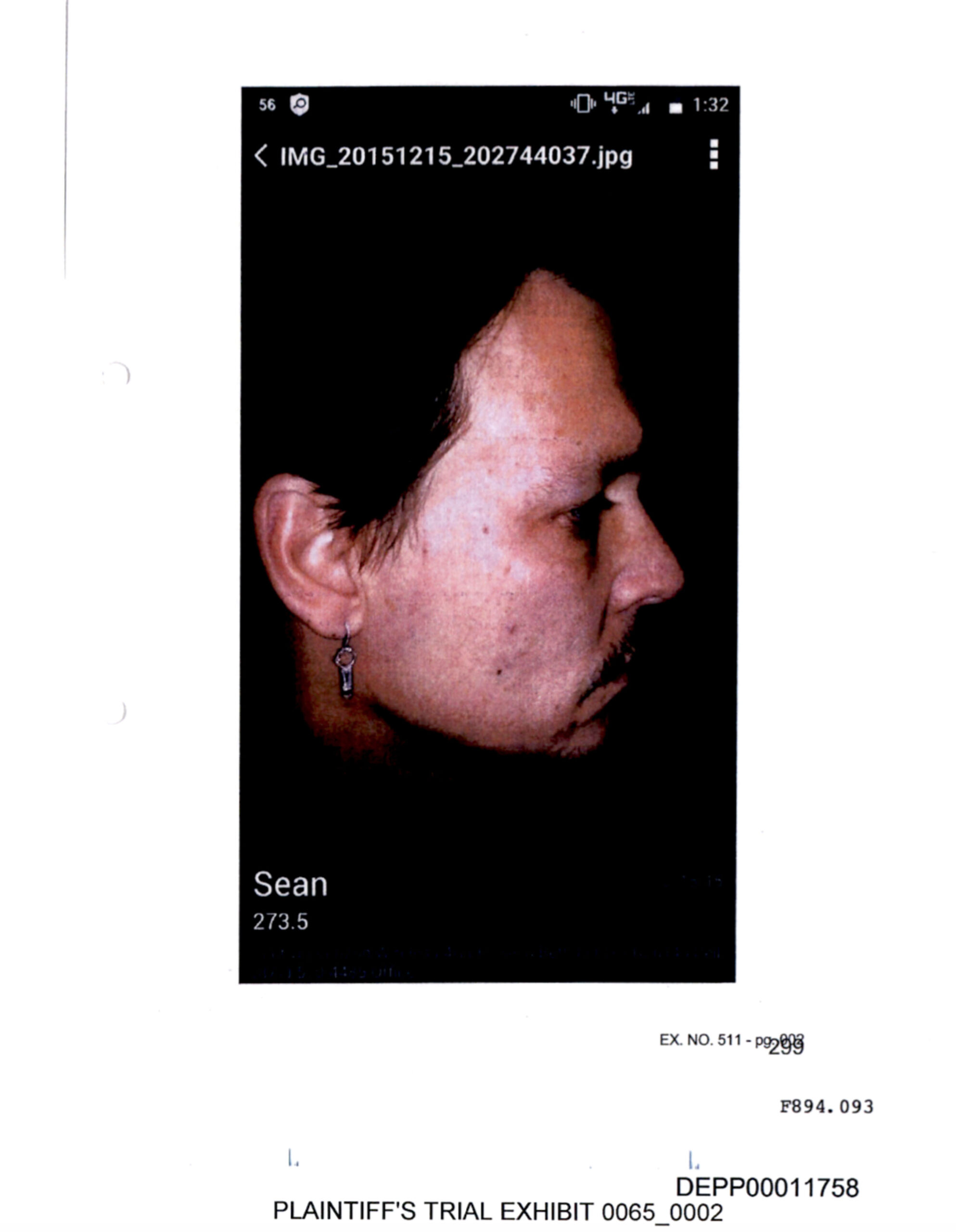 Johnny Depp appears to have bruising to his face in photos submitted as evidence in his defamation trial against ex-wife Amber Heard