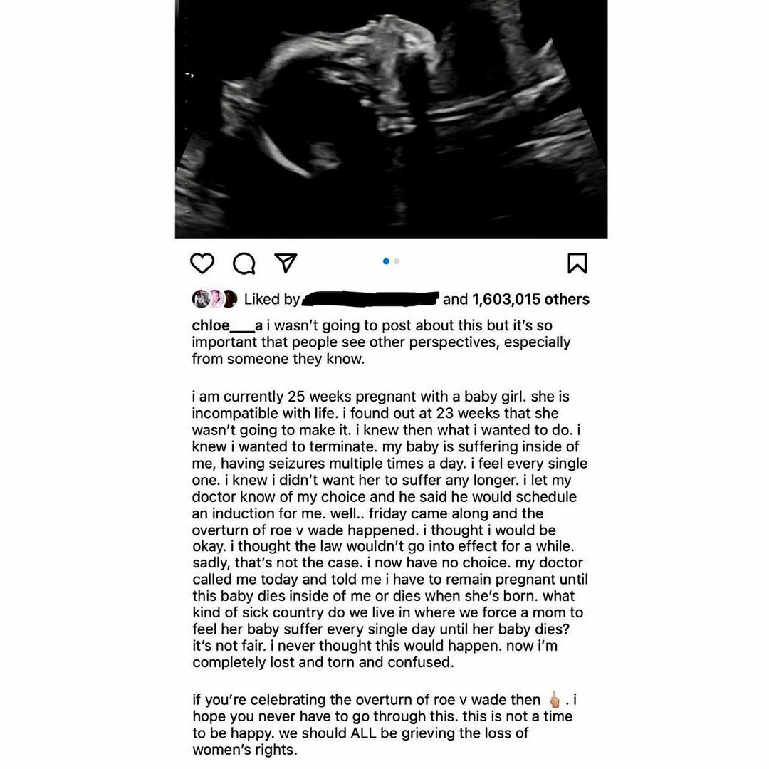 Chloe Partridge's story