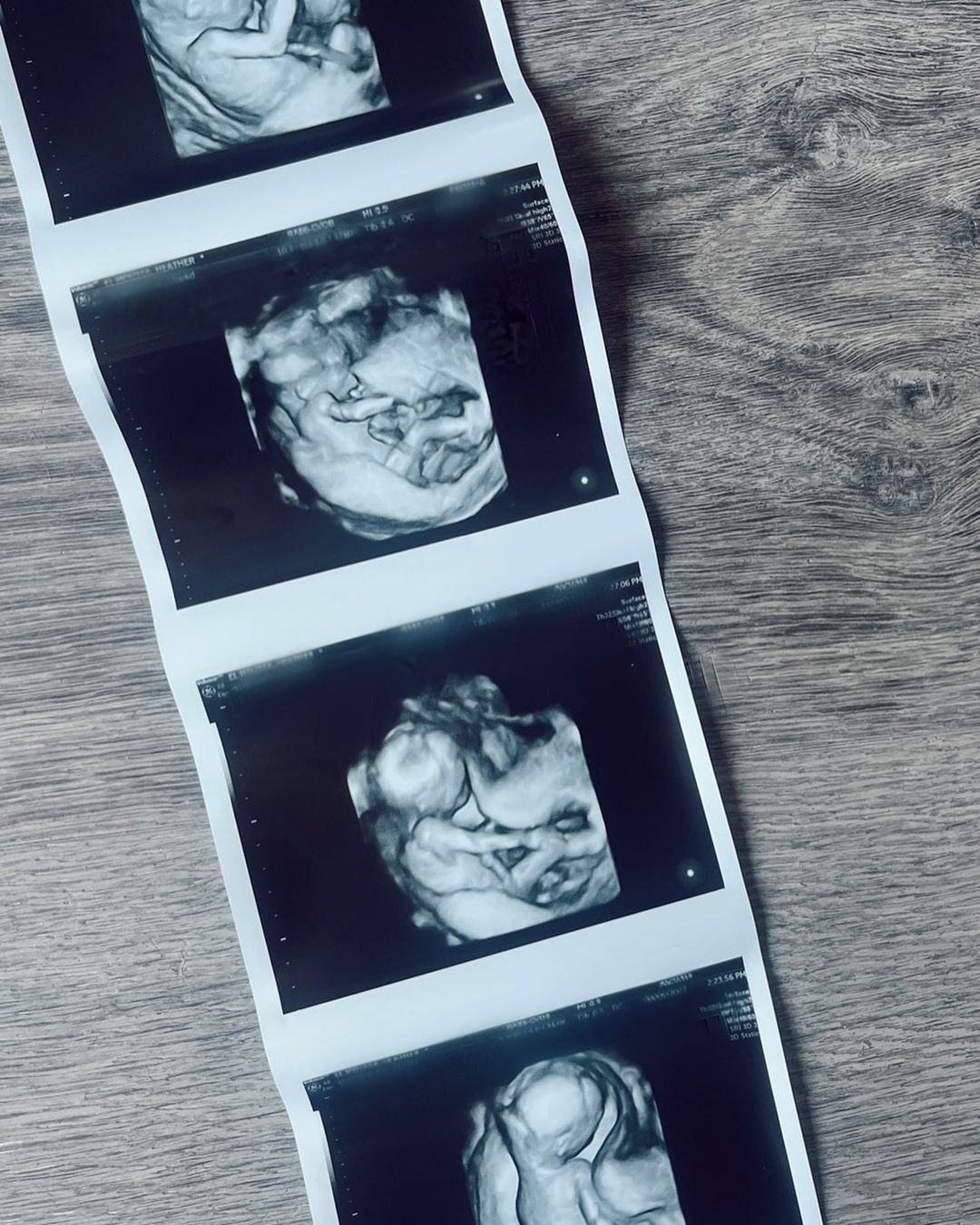 Heather Rae El Moussa's Ultrasound