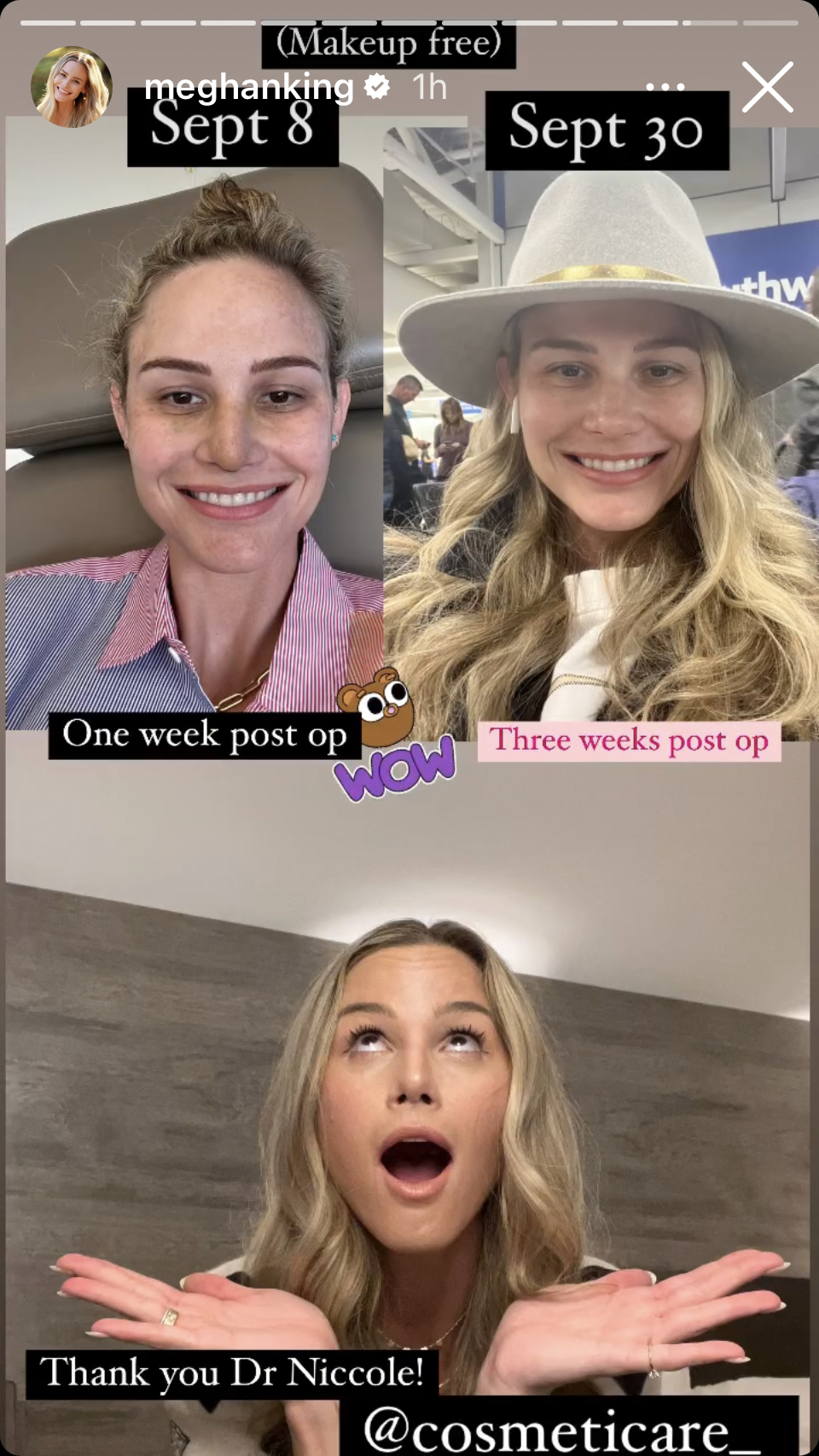Meghan King Story slide