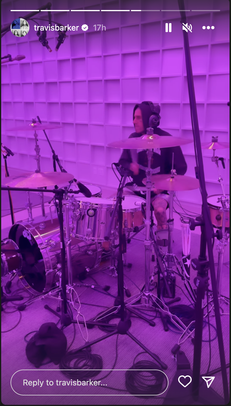 Travis Barker's Broken Toe Didn't Slow Down His Birthday Celebrations