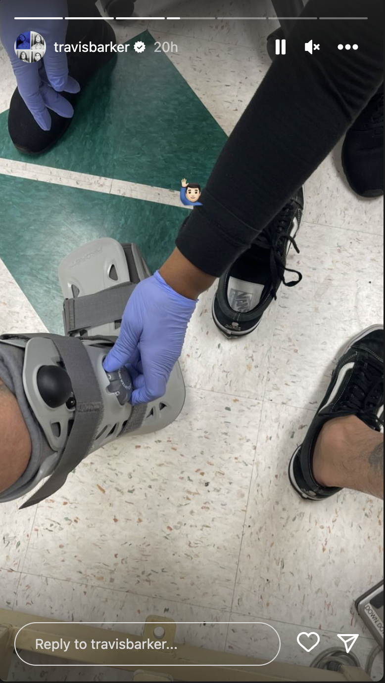 Travis Barker's Broken Toe Didn't Slow Down His Birthday Celebrations