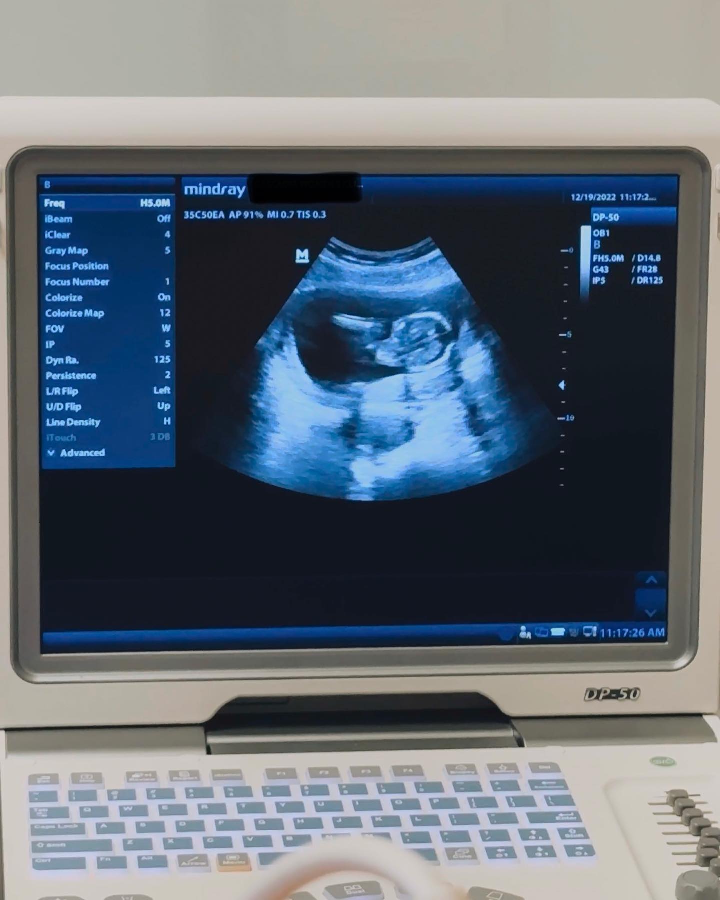 Ireland Baldwin pregnancy announcement