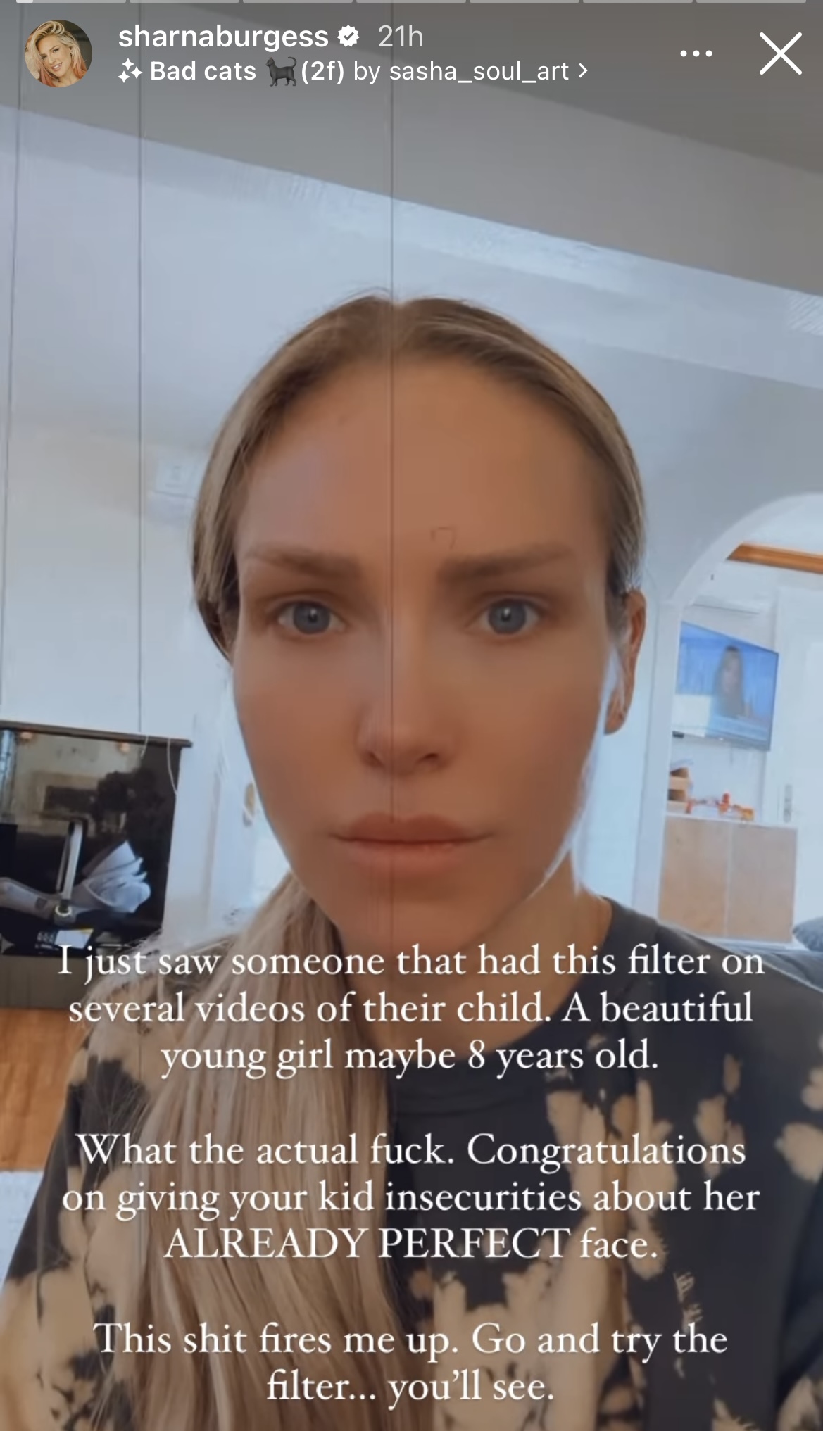 Sharna Burgess slams filter on kids