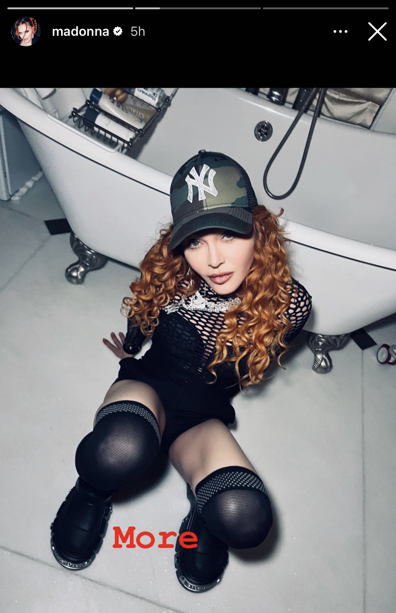 Madonna Has An Important Celebration Tour Question For Her Fans!
