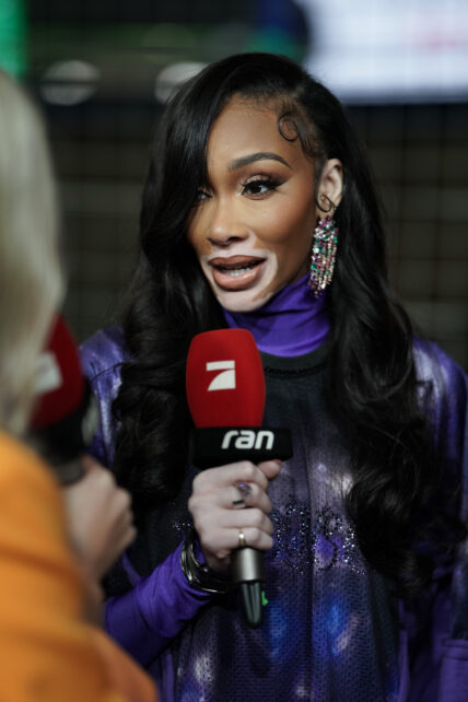 Winnie Harlow
