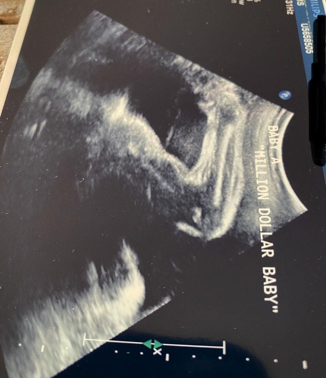 Hilary Swank Shows First Look At Her 'Million Dollar Baby' And Fans Love It