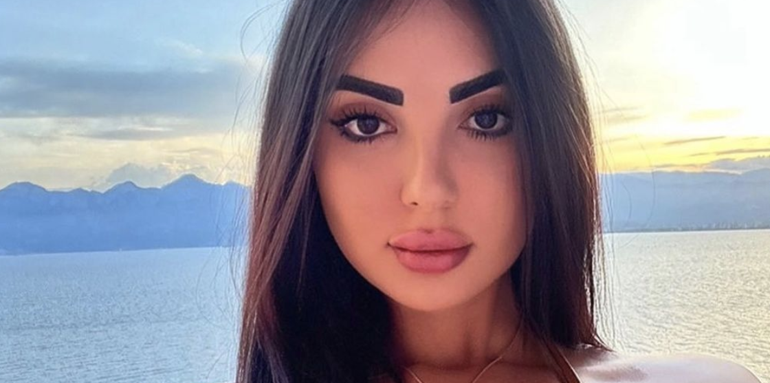Post Surgery Kim Kardashian Look Alike Sick Of The Comparisons, Working On Reversing Procedures