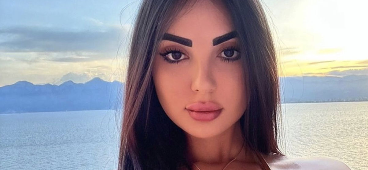 Post Surgery Kim Kardashian Look Alike Sick Of The Comparisons, Working On Reversing Procedures