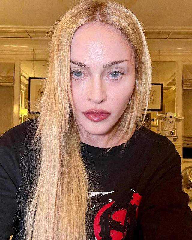 Madonna Breaks Silence On Her Near Death Hospitalization: 'I'm On The Road To Recovery'