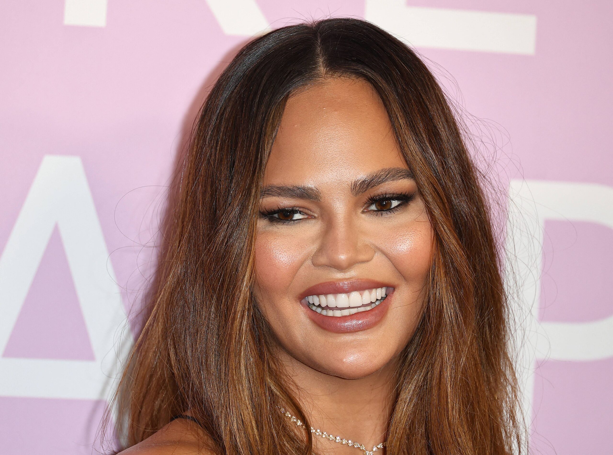 Chrissy Teigen 'Rocks' Green Hair In Latest Instagram Photo