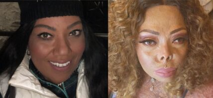 Tonya before the attack (left) Tonya after the attack (right)