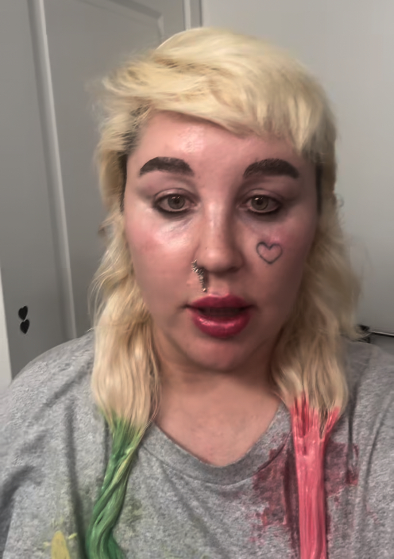 Amanda Bynes announces getting on Ozempic