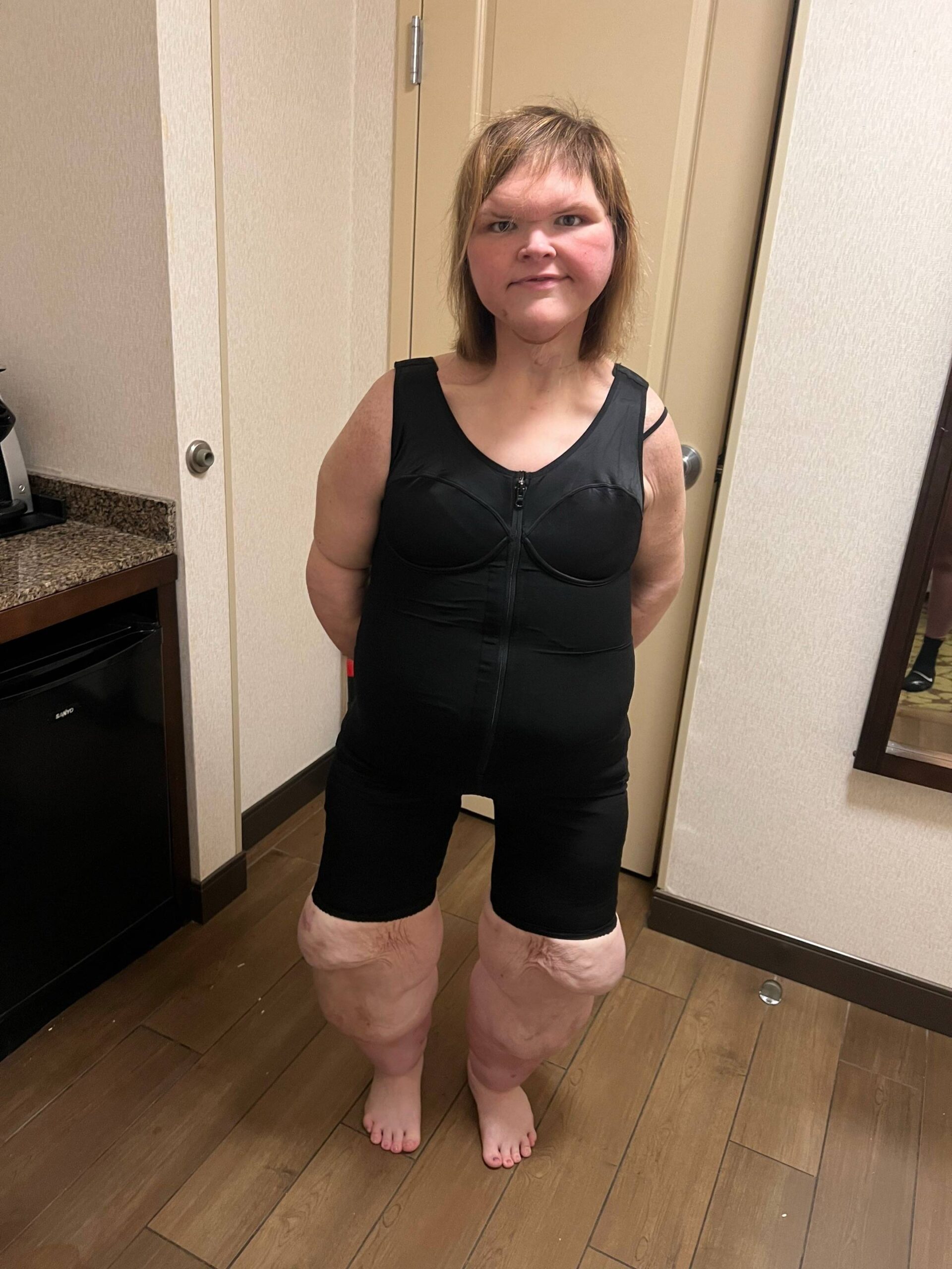Tammy Slaton
