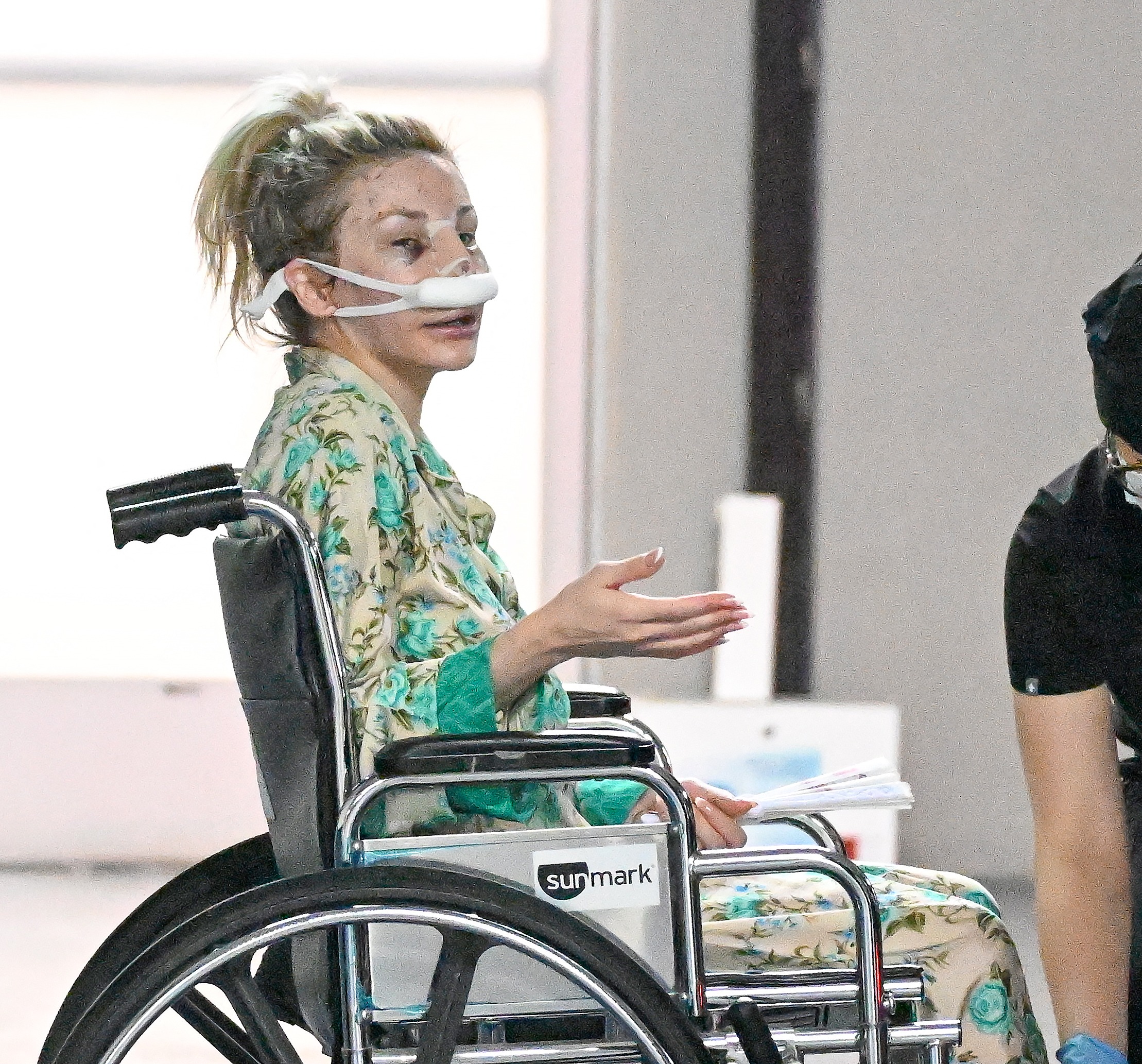 Courtney Stodden leaving Beverly Hills Dr. Motykies office after apparent rhinoplasty