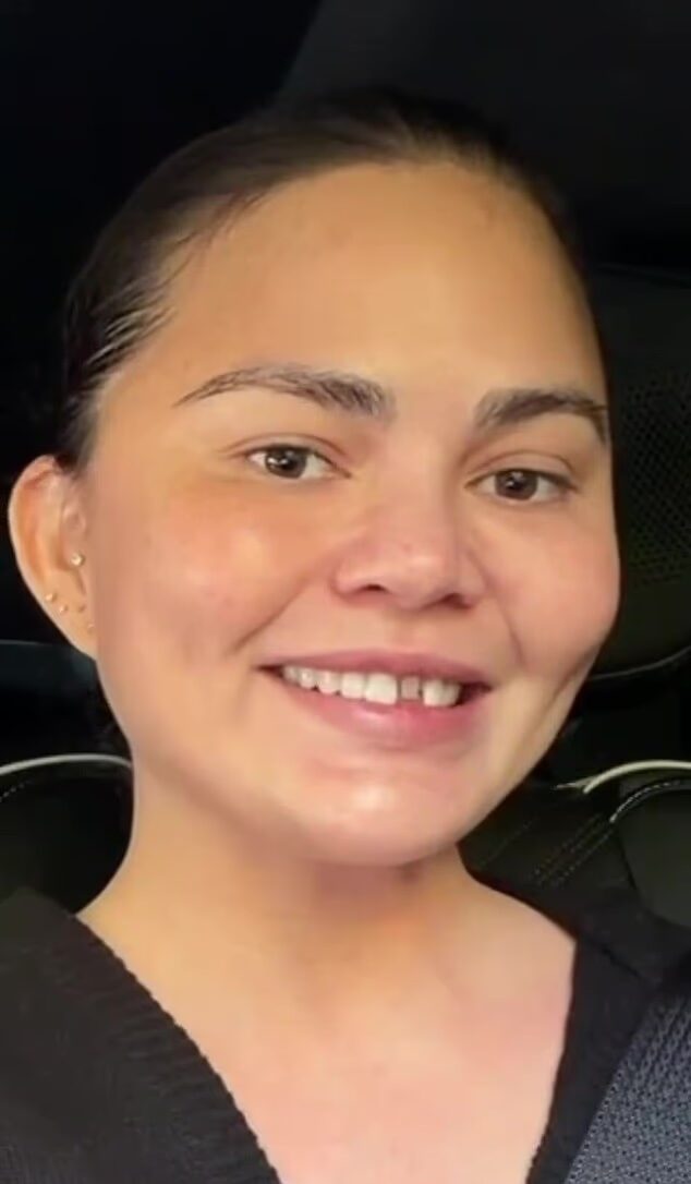 Chrissy Teigen shows off chipped tooth